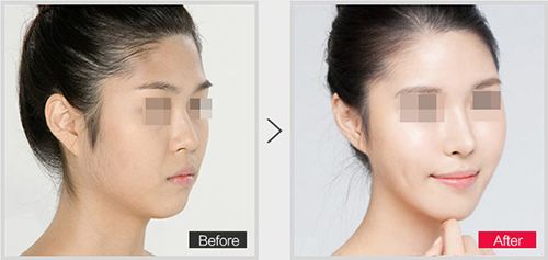 蘭州那家醫(yī)院能治療磨骨比較好？