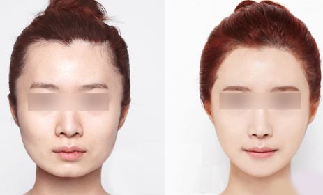 昆明哪里有最好的眼部手術(shù)整形醫(yī)院？2024年10家排名搶先曝光！