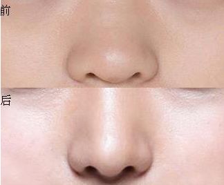 上海三甲整形醫(yī)院盤(pán)點(diǎn)！權(quán)威排行榜揭秘，實(shí)力在線！