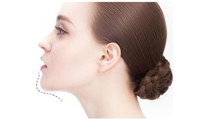 陸軍總院美容科：專家團隊引領腰部吸脂，成功案例揭秘！