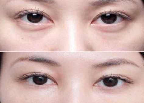 學(xué)生黨必備！性價(jià)比超高的祛黑眼圈眼霜推薦