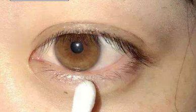 西京醫(yī)院：宋保強(qiáng)醫(yī)生主刀，隆胸手術(shù)安全可靠嗎？