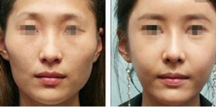 廣州市有哪家醫(yī)療機(jī)構(gòu)提供出色的醫(yī)美美容科服務(wù)？這些被公認(rèn)為優(yōu)質(zhì)的醫(yī)療機(jī)構(gòu)都值得關(guān)注