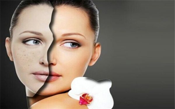 武漢協(xié)和醫(yī)院雙眼皮手術(shù)效果如何？專家簡(jiǎn)介和價(jià)格一覽！