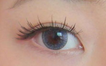 優(yōu)美雙眼輕松可得，了解樓善葉做雙眼皮的詳細過程和真實案例