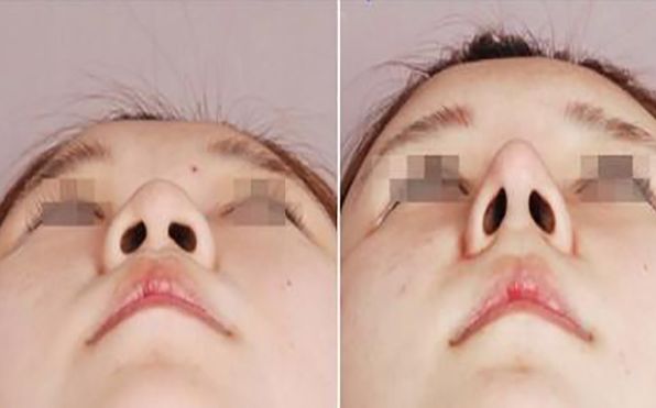 北醫(yī)三院眼科攻略：掛號預(yù)約、專家介紹、2024費用一覽