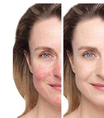 【長春市】優(yōu)質(zhì)整容醫(yī)院推薦！匯總前五家大熱門名單揭曉