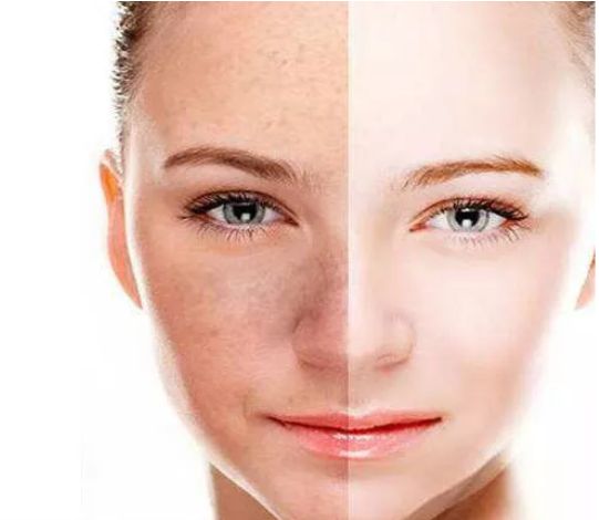 揭露非那雄胺的真相：誤導(dǎo)脫發(fā)患者錯失治療時機