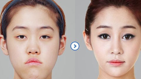 鄂爾多斯市中心醫(yī)院整形外科手術(shù)費用一覽及知名醫(yī)師推薦