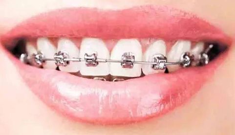 南京美容專(zhuān)家推薦：解決斑點(diǎn)問(wèn)題的好去處！