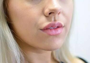 福建省第二人民醫(yī)院整形外科的技術(shù)水平如何？該醫(yī)院整形外科好不好？