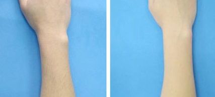 國內(nèi)哪些醫(yī)生做雙眼皮好？王曉亞、李燕、張穎熱門前五推薦！(2023價格表附)