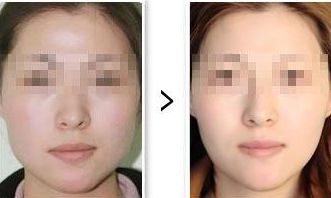 寧波明州醫(yī)院整形美容手術(shù)費(fèi)用及服務(wù)質(zhì)量評(píng)估