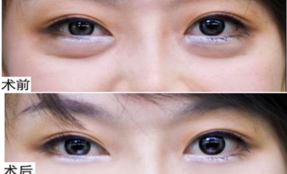 揭曉！鄭州2023年首屈一指的鼻部整形名醫(yī)TOP10震撼排行出爐