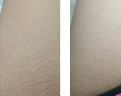 揭秘株洲五家頗受歡迎的整形美容醫(yī)院，哪一家比較好？