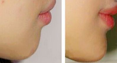 鄭州鼻部整形名醫(yī)盤點(diǎn)！權(quán)威醫(yī)生七人班底完美曝光