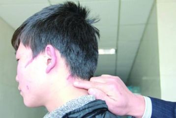 上海哪家醫(yī)院的紋身去除技術(shù)更專業(yè)，排名榜單推薦，實(shí)力強(qiáng)大！