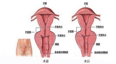 上海祛斑哪家醫(yī)院技術(shù)專業(yè)，效果有保障