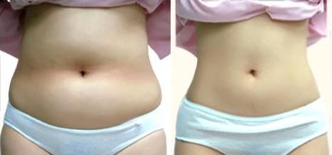 昆明市熱門植發(fā)醫(yī)院排行榜，公立私立都在內(nèi)，你值得擁有更好的選擇