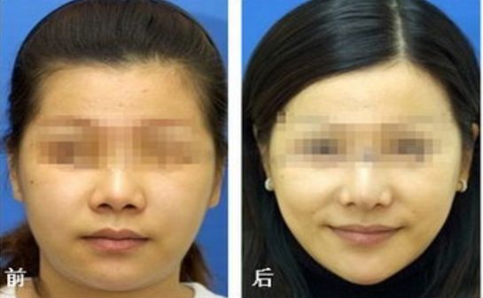 昆明乳房整形哪家醫(yī)院專業(yè)可信？榜單前五推薦，選你中意的