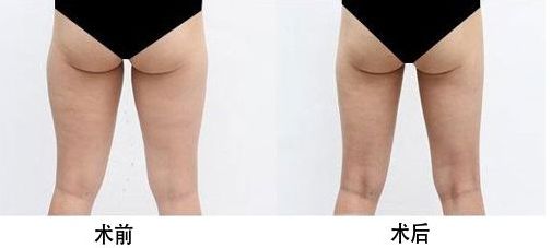 西安雙眼皮修復(fù)醫(yī)生榜單揭曉！頂級專家實力合集！