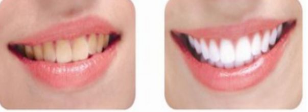 南昌哪家整形醫(yī)院的除皺手術比較好？前十實力醫(yī)院推薦!