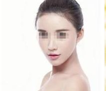 深圳哪家醫(yī)院能安全有效地進(jìn)行隆鼻整形？