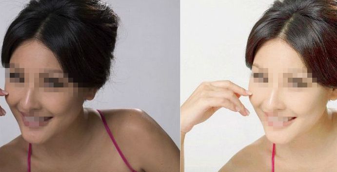 杭州哪家整形醫(yī)院排行前十，驚人綜合評價！絕不能錯過