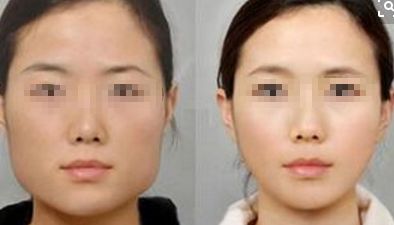 2024年鄭州市熱門整形醫(yī)院推薦，在排名前10中有哪些？