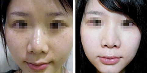 合肥哪幾家三甲整形醫(yī)院受歡迎？