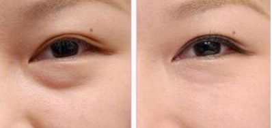 武漢愛(ài)思特整形醫(yī)院值得信賴(lài)嗎？專(zhuān)家團(tuán)隊(duì)丨磨骨案例丨最新報(bào)價(jià)