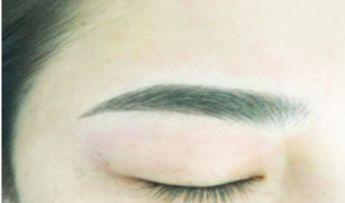 【整形美容】深圳市七家微整形醫(yī)院揭曉！排名榜前七強在線，全城熱議！