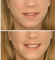 長沙東宸醫(yī)療整容醫(yī)生推薦技術(shù)成果展現(xiàn)，費(fèi)用參考來啦！