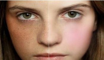 北京哪里做正頜手術好？這幾家醫(yī)院被口碑推崇