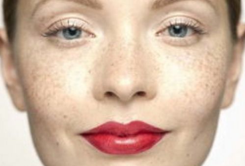 孫澤芳醫(yī)生的眼袋手術(shù)效果如何？醫(yī)生背景資料與實(shí)際手術(shù)對(duì)比圖分享