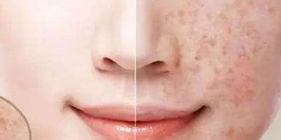 2023年大連顴骨顴弓修復醫(yī)生推薦，醫(yī)師排行公開！附最新收費一覽！