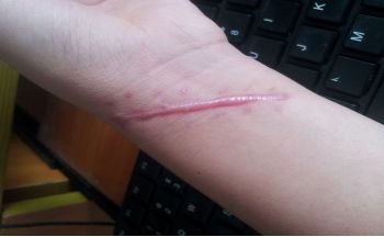 哈爾濱市第五醫(yī)院整容科負責人是誰？名醫(yī)陣容+服務(wù)價目公示給您參考