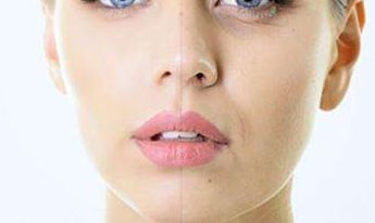 2023醫(yī)生推薦的鼻綜合重塑，讓邱文苑的鼻子煥然一新！