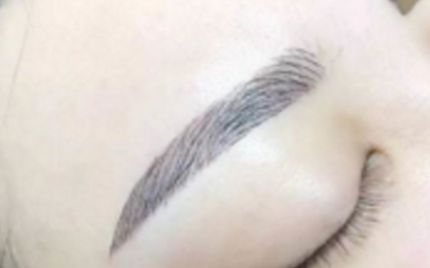 深圳拉皮手術(shù)醫(yī)生五強揭曉！千人口碑薦：排行榜、專家推薦