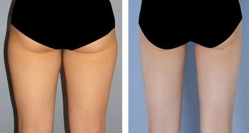 【2023】成都黃金微雕著名醫(yī)師盤點(diǎn)，你不容錯(cuò)過(guò)！