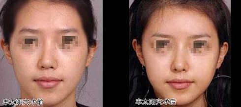 廣州雙眼皮整形市場(chǎng)：熱門口碑機(jī)構(gòu)選擇這幾家準(zhǔn)沒錯(cuò)