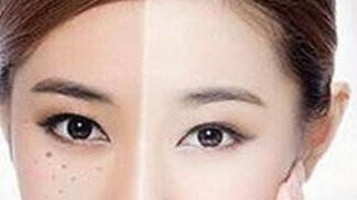 獨家揭秘！了解重慶楊武林醫(yī)生的墊下巴整形全過程