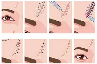 北京八大處很受推崇的隆胸醫(yī)生盤點  備受好評的專家推薦