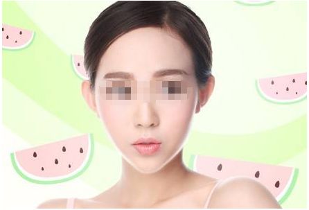 江寶華醫(yī)生的鼻子整形效果如何？醫(yī)生簡介+真實例子分享