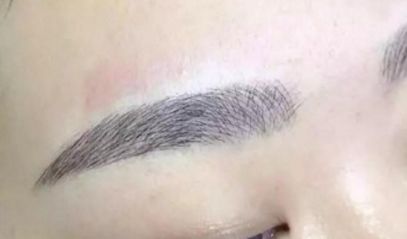 長(zhǎng)沙何瑋醫(yī)生匠心獨(dú)具，驚艷的雙眼皮效果案例匯總