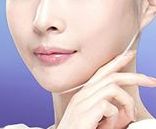 上海星時代張悅迪醫(yī)生精準雙眼皮手術(shù)的2023成功案例分享