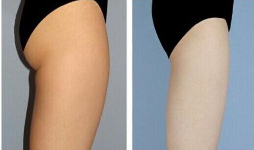 廣州著名種植牙醫(yī)生聚焦！當(dāng)?shù)責(zé)衢T牙醫(yī)簡介匯總