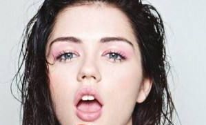 朱亞麗醫(yī)生實(shí)例分享：專業(yè)激光祛斑效果如何？