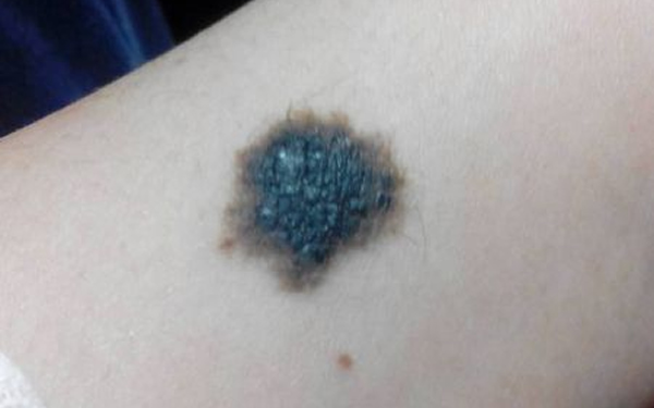 深圳青逸植發(fā)醫(yī)院技術(shù)好不好？醫(yī)生團(tuán)隊(duì)如何？能否令人信任？