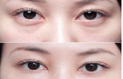 沈陽哪個醫(yī)院的整形專家口碑好，醫(yī)術(shù)高超的醫(yī)生推薦